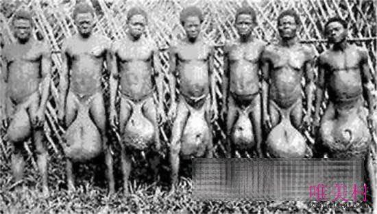 世界上最大的睾丸民族是哪个族 非洲的一个原始部落