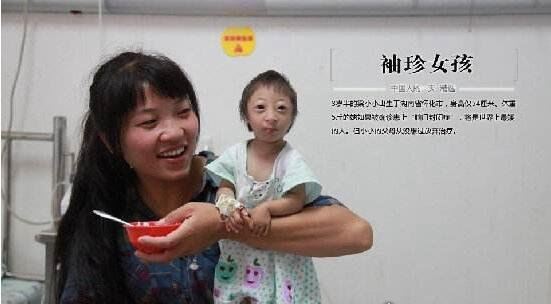 中国袖珍女孩盘点 最矮女孩小小仅54厘米(成世界最矮人)