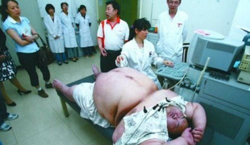 中国第一胖梁用减肥160斤 而孙亮真的是被胖死的