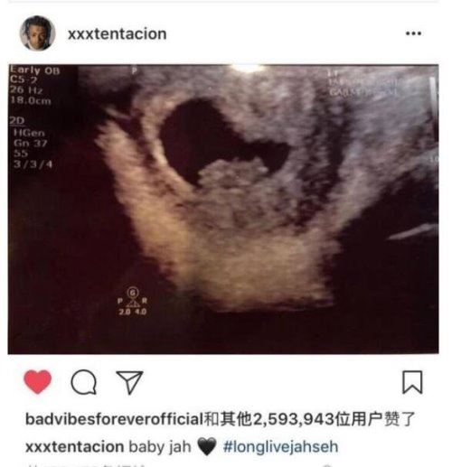 XXXtentacion儿子照片首曝光 取名Gekyume(和X非常像)