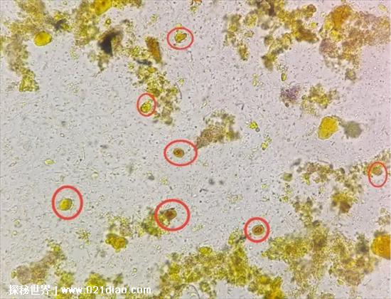 当屎放大1000万倍，我们能够清楚的看到大肠杆菌(很多微生物)