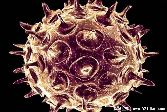 世界上10大最恐怖的病毒 马尔堡病毒（致命病毒）