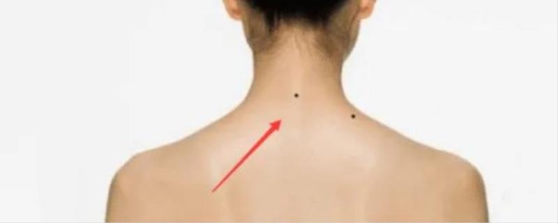 脖子后面有痣代表什么