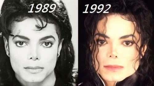 迈克尔杰克逊皮肤病之前和之后的对比