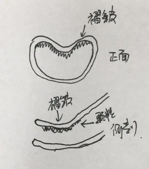 为什么b里面像是有牙齿,老公说我里面像有牙齿一样是怎么回事?