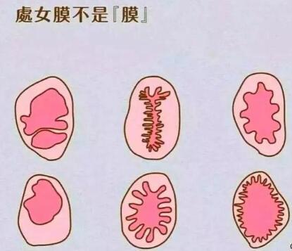 怎么样看自己破没破？用手是不是也属于第一次没了